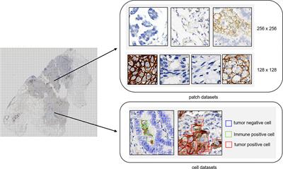 Artificial Intelligence-Assisted Score Analysis for Predicting the Expression of the Immunotherapy Biomarker PD-L1 in Lung Cancer